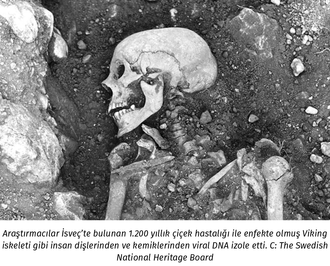 biomedya_Anti̇k dna’ya gore vi̇ki̇ngler  ci̇cek hastaligina yakalanmis_1